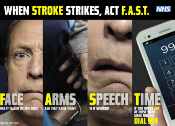 Why You Need to Act Fast in the Event of a Stroke
