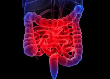 The Invisible Disability: What You Need to Know About IBD